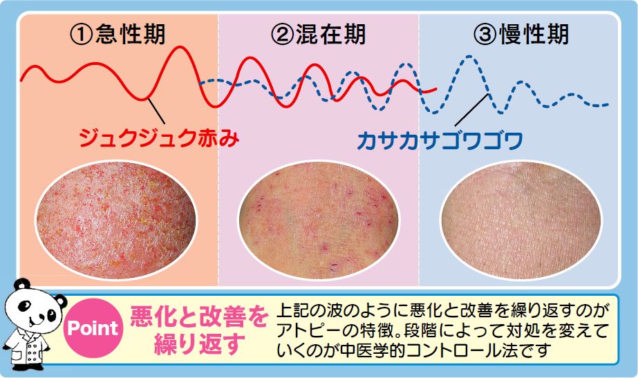 アトピー性皮膚炎でお悩みの方 - 漢方薬局 開気堂薬局